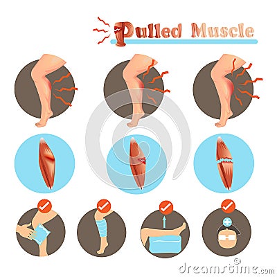 Pulled Muscle Vector Illustration