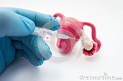 Puncture procedure for egg production, treatment or ovarian stimulation ovulation induction in IVF or gynecology photo concept. Stock Photo