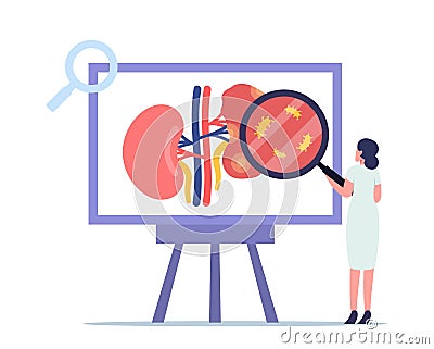 Pyelonephritis, Kidney Healthcare Concept. Tiny Doctor Nephrologist Character Medical Research. Urology and Nephrology Vector Illustration