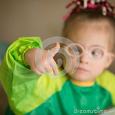 Quite a nice little girl with Down`s syndrome Stock Photo