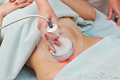 Radio frequency skin tightening machine. Stock Photo