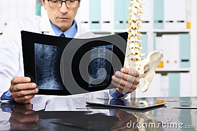 Radiologist doctor checking xray, healthcare, medical concept Stock Photo