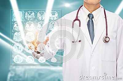 Radiologist doctor touching film brain MRI. Stock Photo