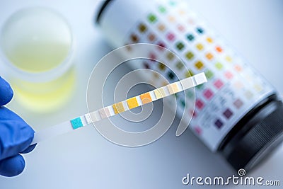 Reagent Strip for Urinalysis , Routine Urinalysis, check-up anal Stock Photo