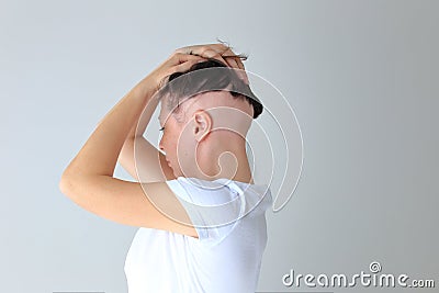 Real alopecia areata in a young girl. A bald head in a person. Stock Photo