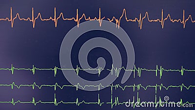cardiograph wiki cardiograph wiki