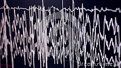 cardiograph wiki cardiograph wiki