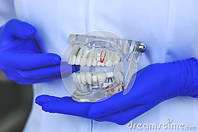 Real dental tooth model showing teeth, roots, gums, gum disease, tooth decay, metal implants and plaque. Dentistry student Stock Photo