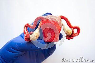 Realistic anatomical model of uterus with ovaries is in hand of doctor, health medical professional or scientist wearing blue glov Stock Photo
