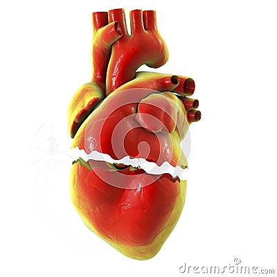 Realistic broken heart, separation and divorce concept Cartoon Illustration