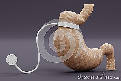 3D Render of Stomach with Gastric Band Stock Photo