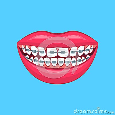 Realistic Detailed 3d Dental Problem on a Blue. Vector Vector Illustration