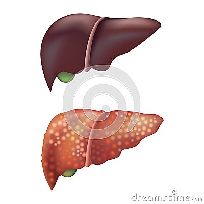 Realistic Detailed 3d Liver Human Internal Organs. Vector Vector Illustration
