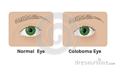 Realistic human normal eyes and with colomba vector illustration design Vector Illustration