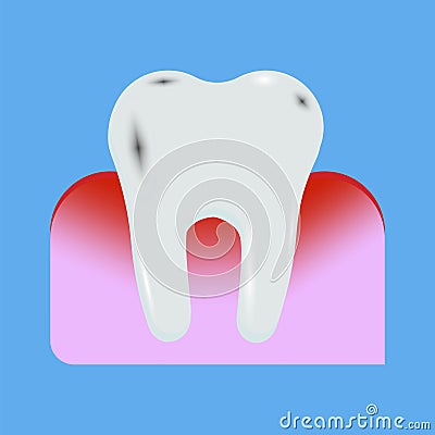 Realistic icon with tooth in the gum for marketing design. Tooth in the gum. Hygiene product. Procedure mask Vector Illustration