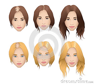 Realistic illustration of woman hair loss Vector Illustration