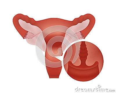 Realistic reproductive system with close-up cross-section. Female human reproductive system with focus on cervix. Vector Illustration