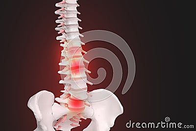 Realistic skeletal human spine and vertebral column or intervertebral discs on a dark background. Lower back pain. Vertebral Stock Photo