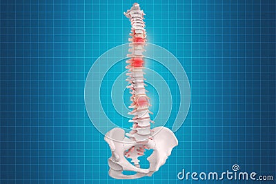 Realistic skeletal human spine and vertebral column or intervertebral discs on a dark background. Lower back pain. Vertebral Stock Photo