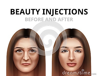 Realistic before and after vector illustration of woman having facial beauty injection. Vector Illustration