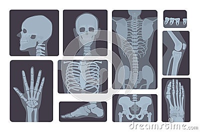 Realistic x-ray shots collection. Human body hand, leg, skull, foot, chest, teeth, spine and other. Vector Illustration