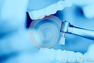 A reception in the dentist`s office, cleaning the enamel of teeth Stock Photo