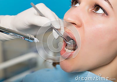 The reception was at the female dentist. Doctor examines the oral cavity on tooth decay. Caries protection. Tooth decay Stock Photo