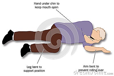 Recovery position Vector Illustration