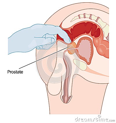 Rectal prostate examination Vector Illustration