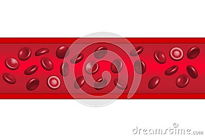 Red blood cells flowing in Atherosclerosis, illustration, Vector Illustration