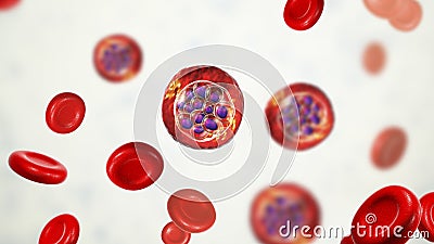 Red blood cells infected with malaria parasite Plasmodium vivax Cartoon Illustration