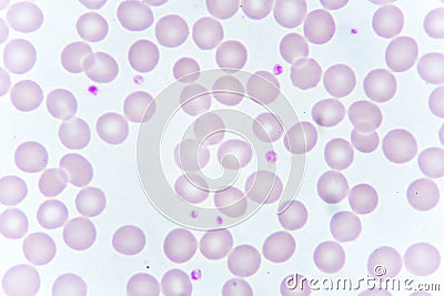 Red blood cells and platelet in blood smear Stock Photo