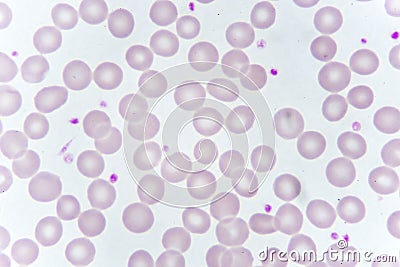 Red blood cells and platelet in blood smear Stock Photo