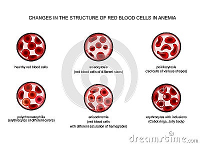 Red blood cells in various anemias Vector Illustration