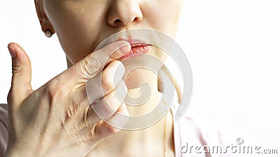 Red bubbles of herpes on lips of a woman in light pink t-shirt, lower part face is seen, which she touches with Stock Photo