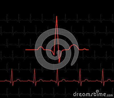 Red EKG symbol on black - medical background Stock Photo