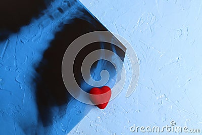 Red heart and phonendoscope near the radiograph of the lungs, chest of a patient with pneumonia. Classic blue background. Copy Stock Photo