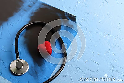 Red heart and phonendoscope near the radiograph of the lungs, chest of a patient with pneumonia. Classic blue background. Copy Stock Photo