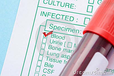 Red mark on test screening form. Stock Photo