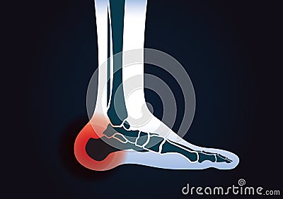 Red signal at heel area. Vector Illustration