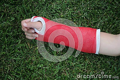 Red wrist arm and hand cast Stock Photo