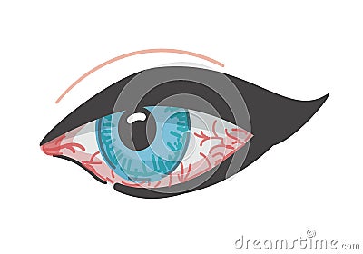 Redness of the eye. Eyeball disease. Vector illustration. Isolated icon. Cartoon style. Conjunctivitis. Vector Illustration