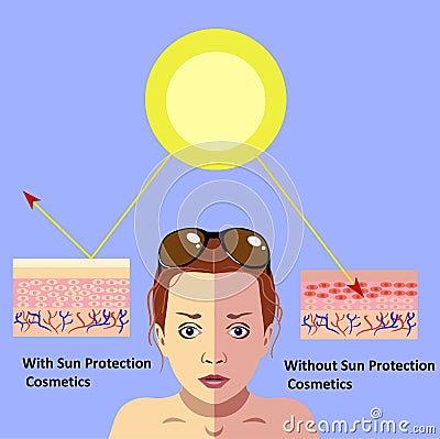 Redness on woman facial and neck skin.Vector Illustration about danger of Ultraviolet Vector Illustration