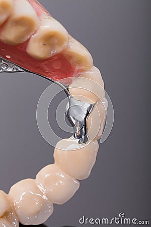 Reduced volume skeletal prosthesis Stock Photo