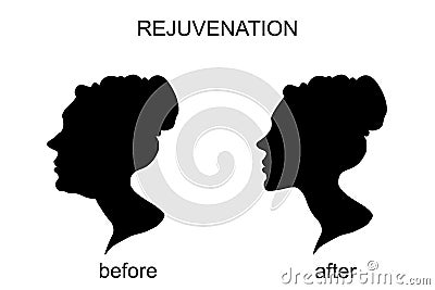 Rejuvenation before and after.a face-lift. chin Stock Photo