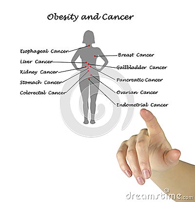 Obesity and Cancer Stock Photo