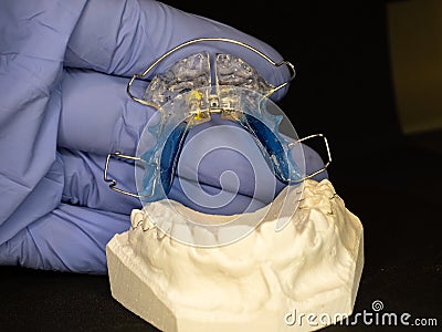 Removable Brace or Retainer for fix birth defect Stock Photo