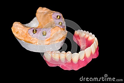 Removable denture Stock Photo