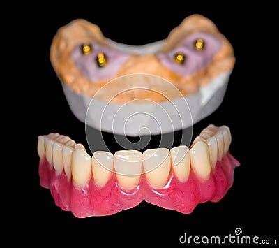 Removable denture Stock Photo