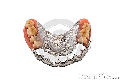 Removable partial metal denture swinglock type on white background Stock Photo